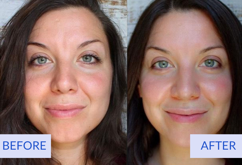 Online 30-Day Skincare Transformation Blueprint